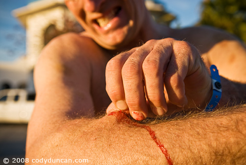 2008 baja 250 San Felipe. Rider pulling cactus thorns from arm after pre-run of course. © Cody Duncan Photography